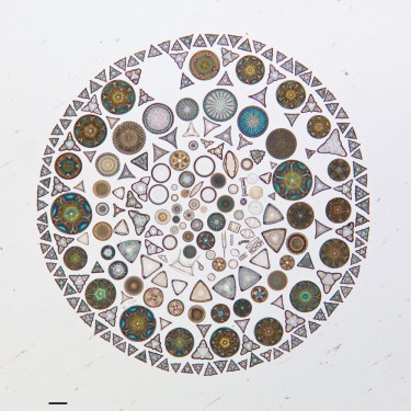 Photograph of diatoms collected in Russia and arranged on a microscope slide in 1952 by A.L. Brigger.